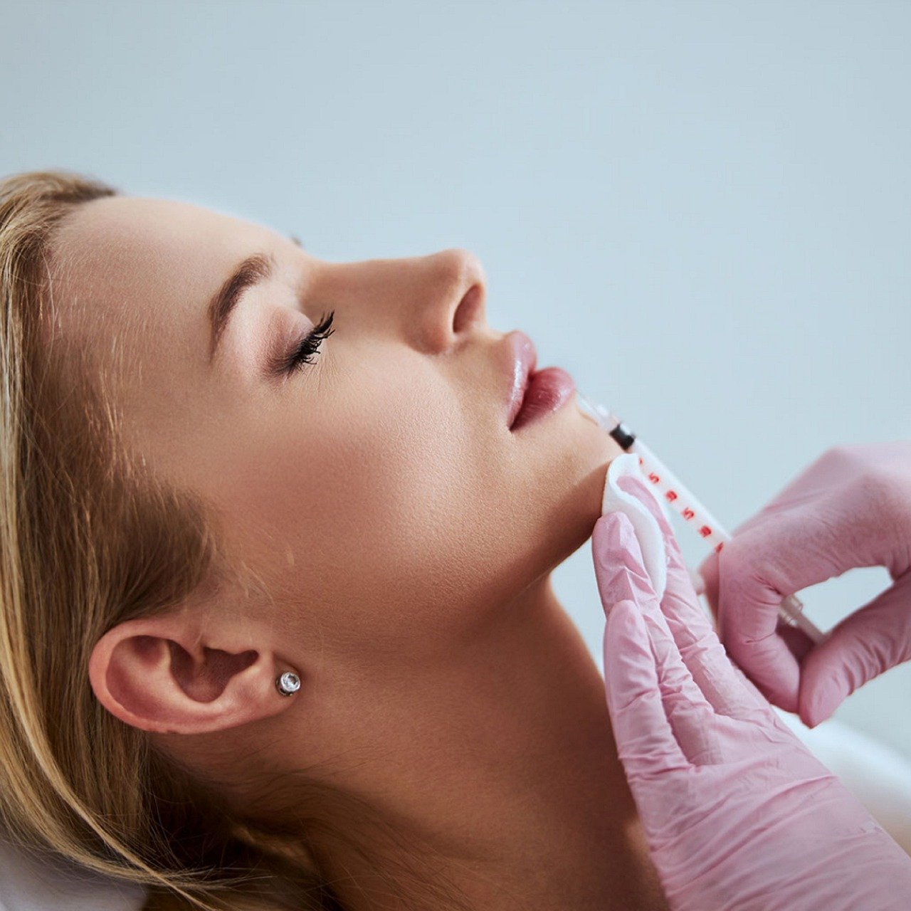 Woman receiving dermal filler lip injections